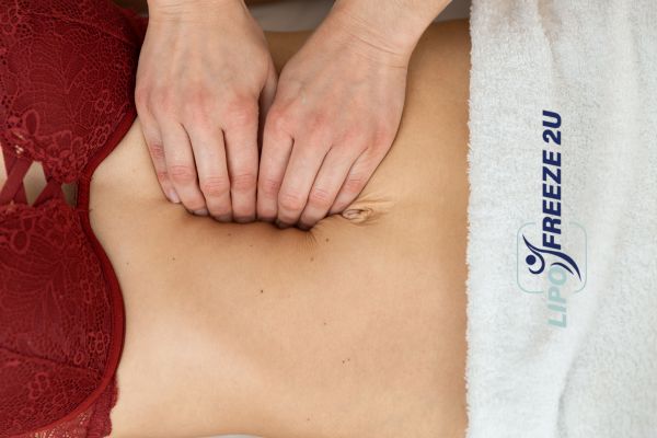diastasis recti treatment Neasden