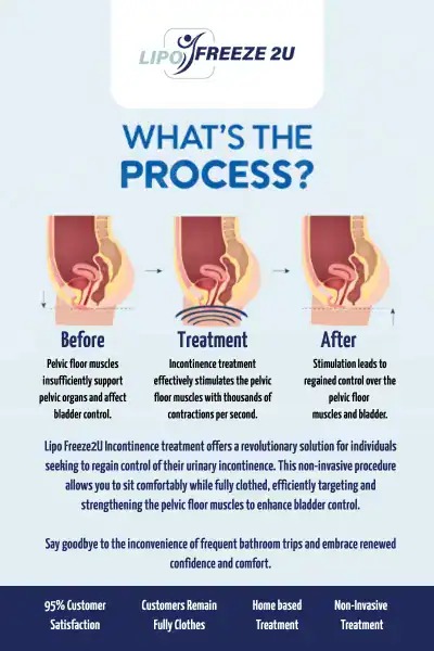 Diagram of how incontinence treatment Neasden works.