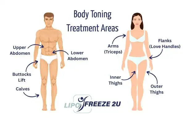 Graphic showing where you can have Body toning Treatment Neasden on your body
