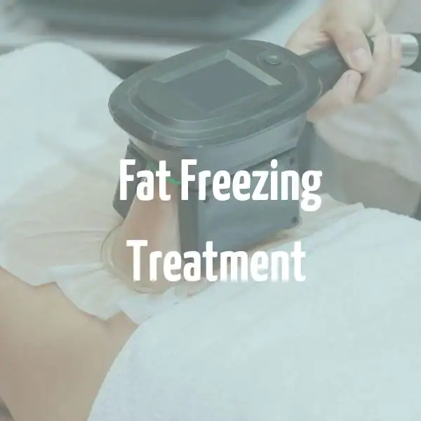 fat freezing treatment Neasden
