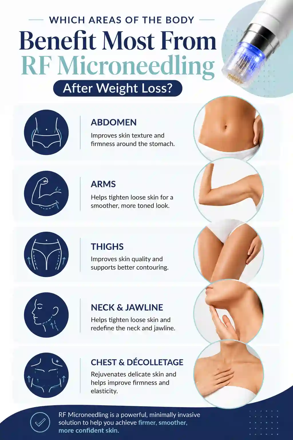 Which Areas of the Body Benefit Most From RF Microneedling After Weight Loss Neasden